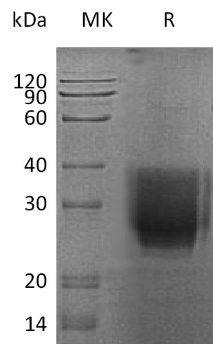 Human EMMPRIN +SDS-PAGE.jpg